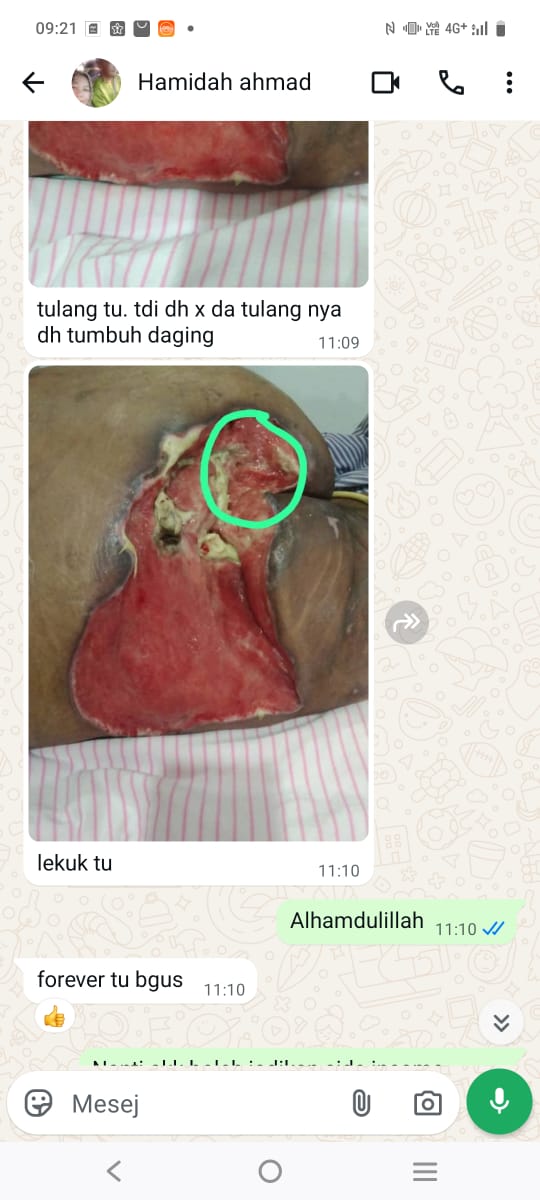 Testimoni Forever 4